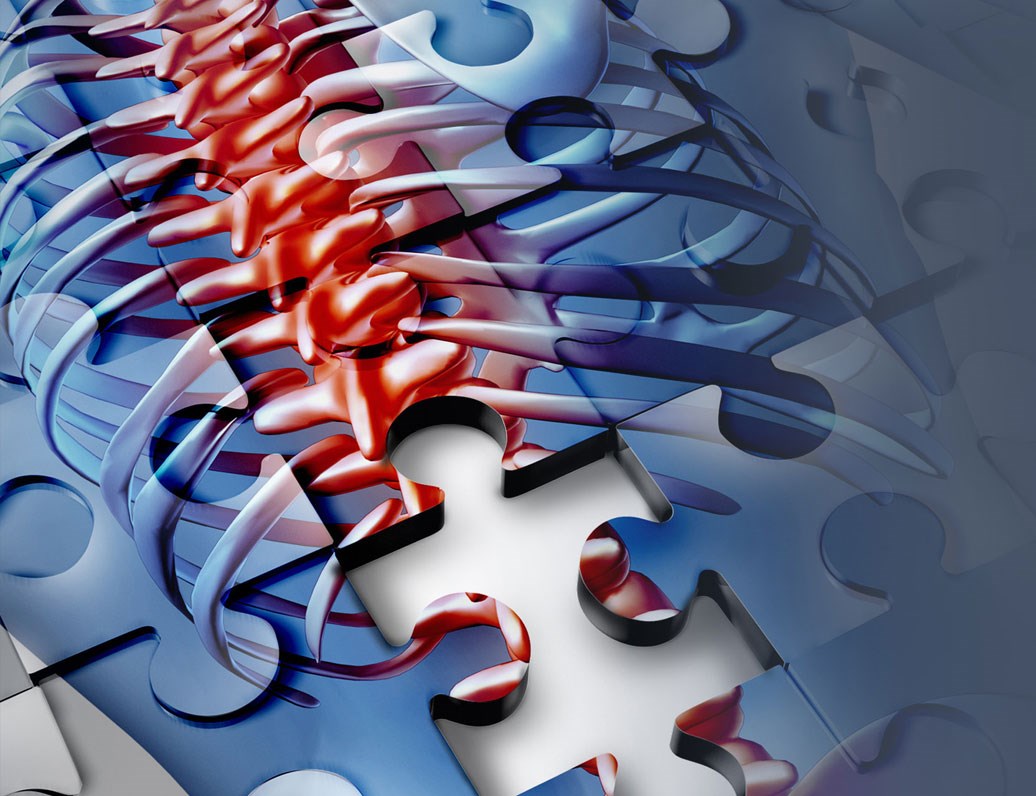 Animal models for the study of compounds in pain therapy: From Screening to Translational Models