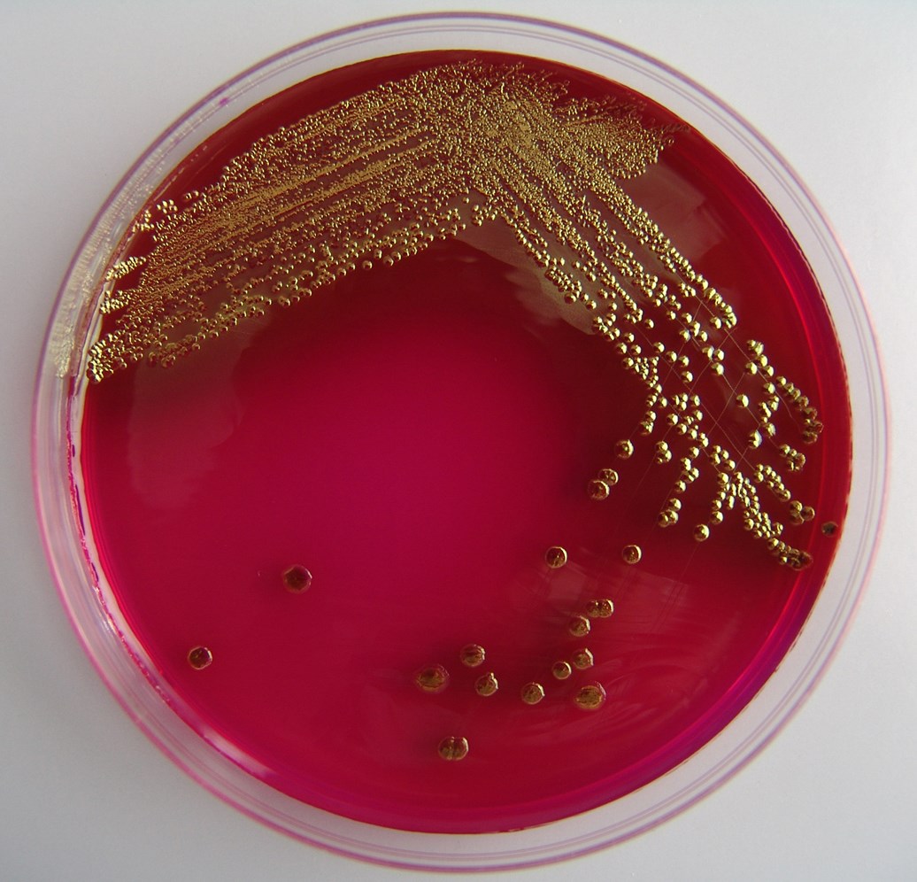 Rapid Microbial Methods